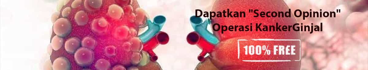 second opinion second opinion